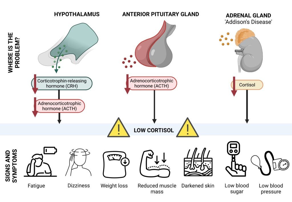 What Is Cortisol? - Nurse Sarah Barker