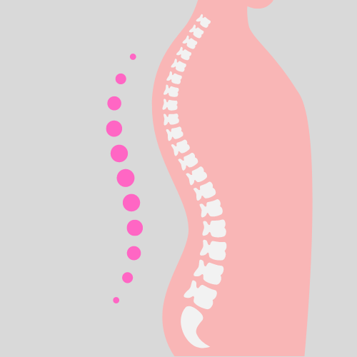 Spinal Flow Technique