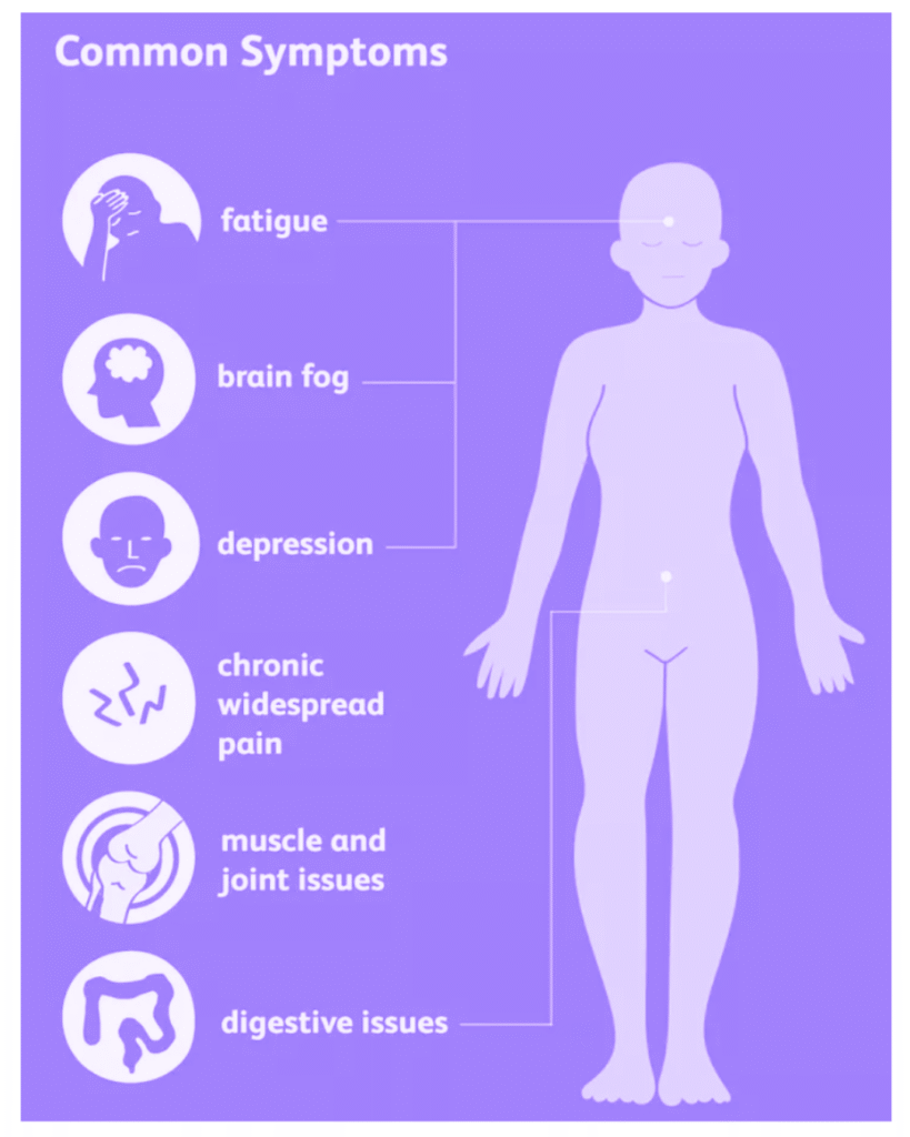 fibromyalgia